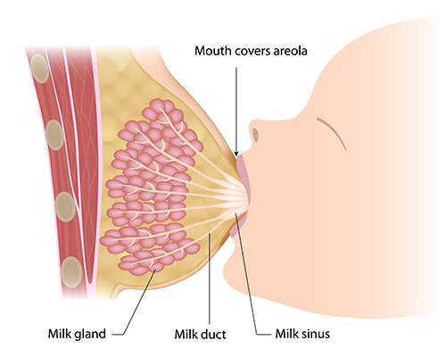 A surgical procedure to correct saggy and shapeless breasts after